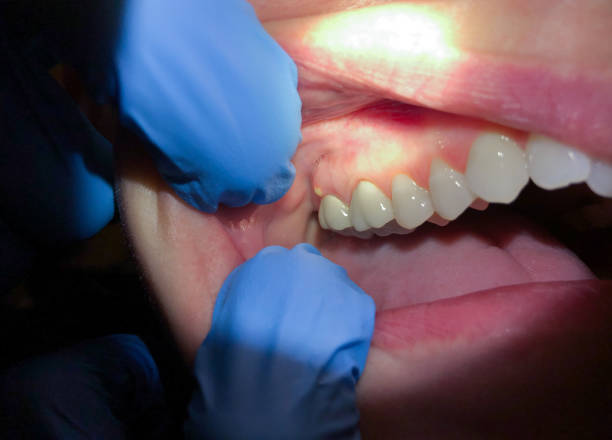 Best Urgent Care for Lost Fillings or Crowns in Aldan, PA